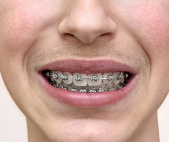Before Image